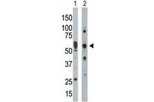 Western Blotting (WB) image for anti-Eukaryotic Translation Initiation Factor 2-alpha Kinase 2 (EIF2AK2) (AA 519-550) antibody (ABIN3030885)