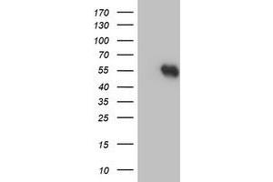 HEK293T cells were transfected with the pCMV6-ENTRY control (Left lane) or pCMV6-ENTRY RUVBL2 (Right lane) cDNA for 48 hrs and lysed. (RUVBL2 antibody  (AA 113-370))