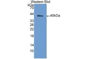 Western Blotting (WB) image for anti-Angiostatin (ANG) (AA 98-436) antibody (ABIN1174432)