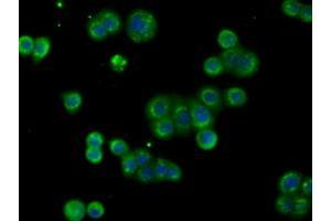 Image no. 2 for anti-Acetyl-CoA Acetyltransferase 2 (ACAT2) antibody (ABIN1496399) (ACAT2 antibody)