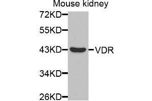 Western blot analysis of extracts of mouse kidney cells, using VDR antibody. (Vitamin D Receptor antibody)