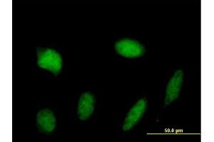 Immunofluorescence of purified MaxPab antibody to STAT5A on HeLa cell. (STAT5A antibody  (AA 1-794))