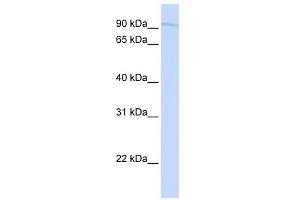 SYDE1 antibody used at 1 ug/ml to detect target protein. (SYDE1 antibody)