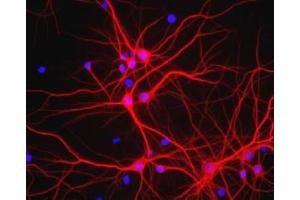 Immunofluorescence - MAP2 Antibody. (MAP2 antibody)