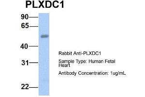 Host:  Rabbit  Target Name:  PLXDC1  Sample Type:  Human Fetal Heart  Antibody Dilution:  1. (PLXDC1 antibody  (N-Term))