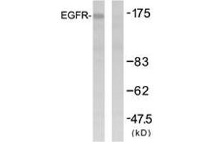 Western blot analysis of extracts from HuvEc cells, using EGFR (Ab-1092) Antibody. (EGFR antibody  (AA 1061-1110))