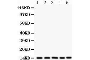 Western Blotting (WB) image for anti-Fatty Acid Binding Protein 1, Liver (FABP1) (AA 6-36), (N-Term) antibody (ABIN3042384) (FABP1 antibody  (N-Term))