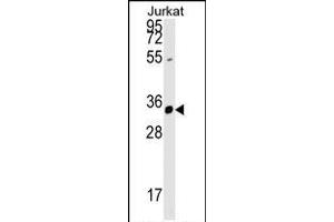 ZFYVE27 Antibody (N-term) (ABIN1539257 and ABIN2848777) western blot analysis in Jurkat cell line lysates (35 μg/lane). (ZFYVE27 antibody  (N-Term))