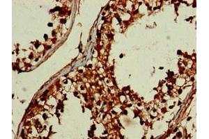 Immunohistochemistry of paraffin-embedded human testis tissue using ABIN7149738 at dilution of 1:100 (DEPDC1B antibody  (AA 343-529))