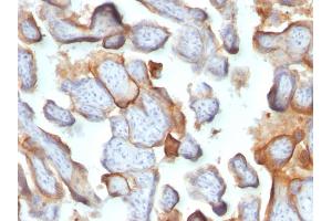 Formalin-fixed, paraffin-embedded human Placenta stained with hCG beta Monoclonal Antibody (SPM105). (CGB antibody)