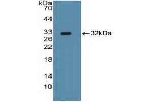 Detection of Recombinant Smad5, Human using Polyclonal Antibody to SMAD family member 5 (SMAD5) (SMAD5 antibody  (AA 210-464))