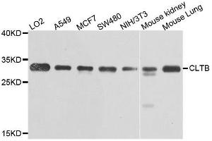Western blot analysis of extracts of various cell lines, using CLTB antibody. (CLTB antibody  (AA 1-211))