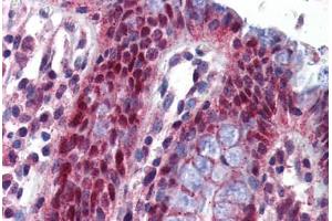 Human Colon: Formalin-Fixed, Paraffin-Embedded (FFPE) (NLRP1 antibody  (AA 323-372))