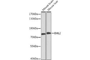 Western blot analysis of extracts of various cell lines, using EML2 Rabbit pAb (ABIN6127842, ABIN6140161, ABIN6140163 and ABIN6218510) at 1:3000 dilution.