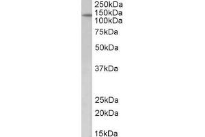 ABIN1590007 (2µg/ml) staining of Mouse fetal Kidney lysate (35µg protein in RIPA buffer). (Patched 1 antibody  (AA 266-280))