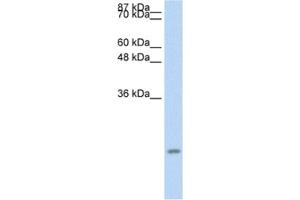 Western Blotting (WB) image for anti-Chemokine (C-C Motif) Ligand 13 (CCL13) antibody (ABIN2463694) (CCL13 antibody)