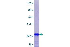 MT2A Protein (AA 1-61) (GST tag)