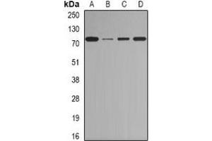 Western blot analysis of BORIS expression in Jurkat (A), Hela (B), mouse heart (C), rat testis (D) whole cell lysates. (CTCFL antibody)