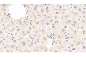 Immunohistochemistry (IHC) image for anti-Retinol Binding Protein 4, Plasma (RBP4) (AA 63-245) antibody (ABIN7429286)