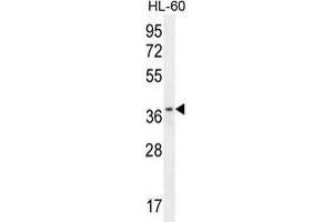 ZNF322B Antibody (C-term) western blot analysis in HL-60 cell line lysates (35 µg/lane). (ZNF322P1 antibody  (C-Term))