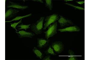 Immunofluorescence of purified MaxPab antibody to LGALS1 on HeLa cell. (LGALS1/Galectin 1 antibody  (AA 1-135))