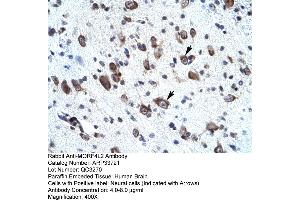 Rabbit Anti-MORF4L2 Antibody       Paraffin Embedded Tissue:  Human neural cell   Cellular Data:  Epithelial cells of renal tubule  Antibody Concentration:   4. (MORF4L2 antibody  (N-Term))