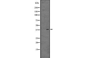 Western blot analysis of GPR81 expression in 293 cell line lysate ;,The lane on the left is treated with the antigen-specific peptide. (GPR81 antibody  (C-Term))
