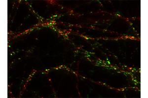 Indirect immunostaining of PFA fixed rat hippocampus neurons with anti-homer 1b/c (dilution 1 : 500; red) and mouse anti-synapsin 1 (, dilution 1 : 500; green).