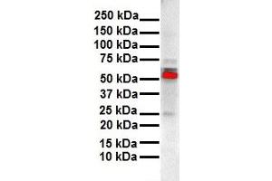 WB Suggested Anti-ESR2 antibody Titration: 1 ug/mL Sample Type: Human liver (ESR2 antibody  (N-Term))