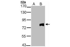 WB Image Western Blot analysis of MID2 expression in transfected 293T cell line by MID2 polyclonal antibody.