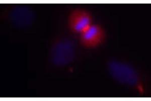Immunofluorescence staining of methanol-fixed HeLa cells using AKT1 (Ab-450) Antibody (E021502, Red) (AKT1 antibody)