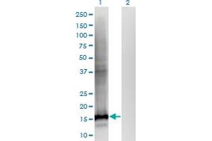 Western Blot analysis of WDHD1 expression in transfected 293T cell line by WDHD1 monoclonal antibody (M01), clone 2F10.