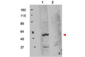 Western blot using FKBP8 polyclonal antibody  shows detection of exogenous FKBP8 in 50 ug of HEK293T whole cell lysate (Lane 1). (FKBP8 antibody  (Internal Region))