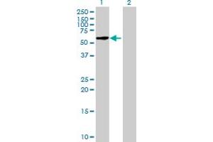 Western Blot analysis of FBXO33 expression in transfected 293T cell line by FBXO33 MaxPab polyclonal antibody. (FBXO33 antibody  (AA 1-555))