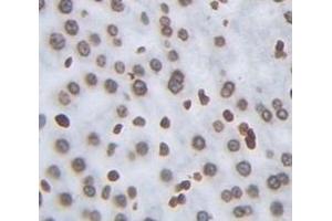 Figure. (PSIP1 antibody  (AA 311-469))
