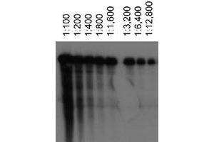 Western blot analysis of ABCA1 using ABCA1 monoclonal antibody, clone 3A1. (ABCA1 antibody)