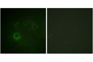Immunofluorescence analysis of COS7 cells, using p70 S6 Kinase (Phospho-Ser418) Antibody. (RPS6KB1 antibody  (pSer418))