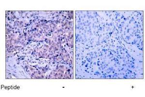 Image no. 2 for anti-3-phosphoinositide Dependent Protein Kinase-1 (PDPK1) (Ser241) antibody (ABIN197100) (PDPK1 antibody  (Ser241))