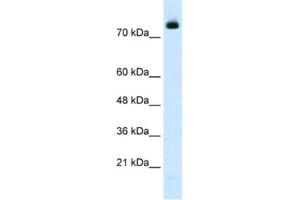 Western Blotting (WB) image for anti-Zinc Finger Protein 261 (ZMYM3) antibody (ABIN2460974) (ZMYM3 antibody)