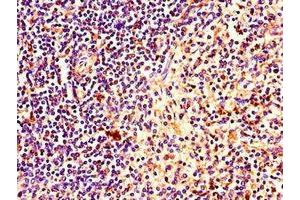 Immunohistochemistry of paraffin-embedded human spleen tissue using ABIN7169153 at dilution of 1:100 (PINK1 antibody  (AA 162-272))