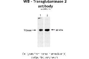 Image no. 1 for anti-Transglutaminase 2 (C Polypeptide, Protein-Glutamine-gamma-Glutamyltransferase) (TGM2) antibody (ABIN346957) (Transglutaminase 2 antibody)
