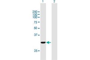 Western Blot analysis of COASY expression in transfected 293T cell line by COASY MaxPab polyclonal antibody. (COASY antibody  (AA 1-269))