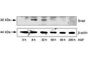 Western Blotting (WB) image for anti-SNAIL (SNAI1) (AA 9-39) antibody (ABIN3032657)