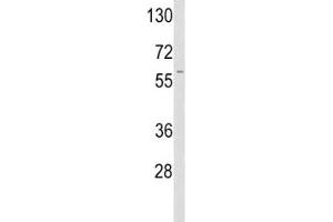 Western blot analysis of TPA antibody and A2058 lysate.