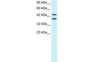 Western Blotting (WB) image for anti-Zinc Finger Protein 839 (ZNF839) antibody (ABIN2460607) (ZNF839 antibody)