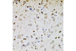 Immunohistochemistry of paraffin-embedded mouse brain using ALDH1A1 antibody.