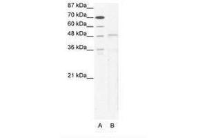 Image no. 1 for anti-T-Box 5 (TBX5) (AA 124-173) antibody (ABIN203164) (T-Box 5 antibody  (AA 124-173))