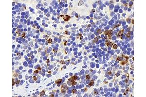 Immunohistochemistry analysis of parafffin-embedded rat spleen using Lysozyme Polyclonal Antibody at dilution of 1:400. (LYZ antibody)