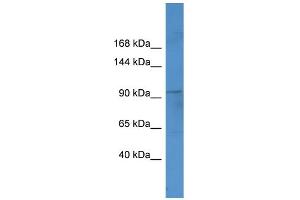 WB Suggested Anti-Ftsj3 Antibody Titration:  0. (FTSJ3 antibody  (C-Term))