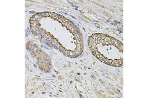 Immunohistochemistry of paraffin-embedded human prostate using S100A12 antibody. (S100A12 antibody  (AA 1-92))